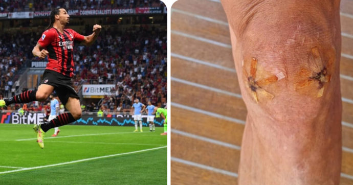 Ibrahimovic, sui social la foto dell’infortunio al ginocchio di maggio: così lo svedese celebra il ritorno al gol contro la Lazio