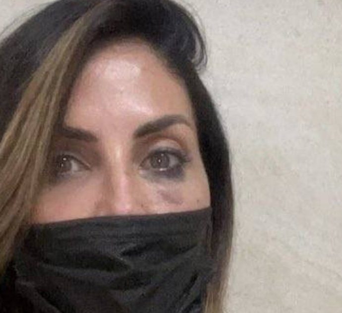 Guendalina Tavassi al processo contro l’ex marito: “Mi ha inseguito con una mazza da baseball e mi ha preso a bastonate in testa”
