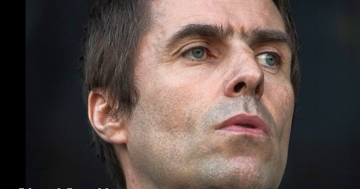 Liam Gallagher con il volto tumefatto dopo un incidente sull’elicottero: “Chi ha detto che il rock è morto?”