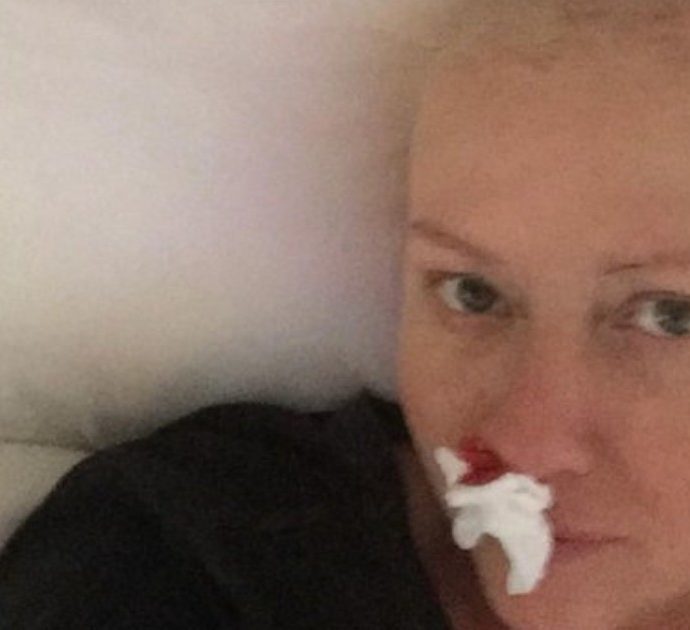 Shannen Doherty pubblica alcune foto scioccanti a letto: “Questo è il cancro. È tutto carino? No, ma è veritiero”