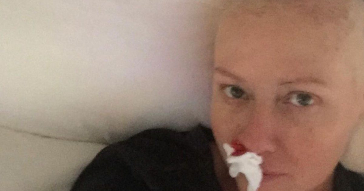 Shannen Doherty e la foto per sensibilizzare: “Mostro l’aspetto del cancro. Fate mammografie, controlli”