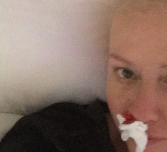 Shannen Doherty e la foto per sensibilizzare: “Mostro l’aspetto del cancro. Fate mammografie, controlli”