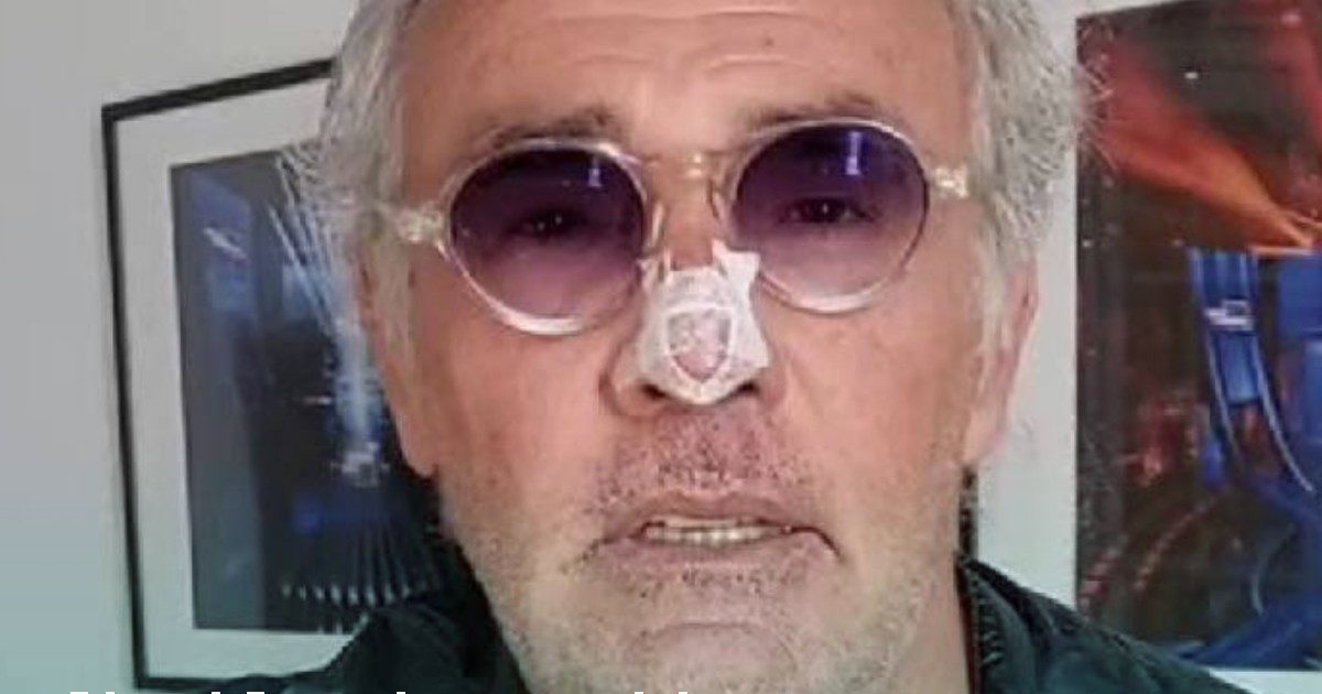 Massimo Giletti, brutto incidente per il conduttore: “Mi sono fratturato il naso giocando a calcio”