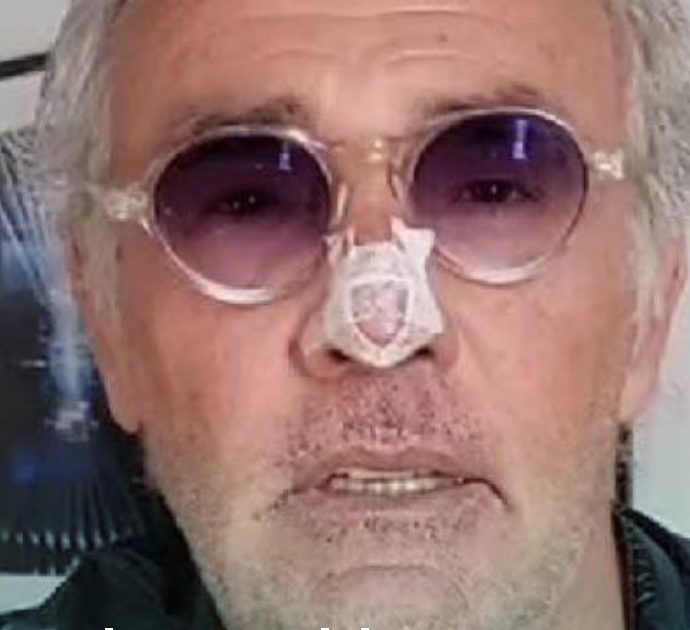 Massimo Giletti, brutto incidente per il conduttore: “Mi sono fratturato il naso giocando a calcio”