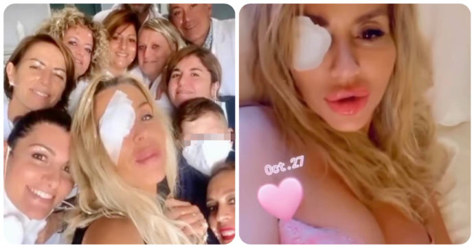 Valeria Marini con un occhio bendato: si è sottoposta ad un delicato intervento alla retina. Alfonso Signorini: “Torni meglio di prima”