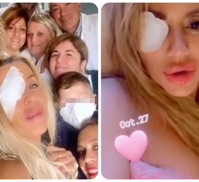 Valeria Marini con un occhio bendato: si è sottoposta ad un delicato intervento alla retina. Alfonso Signorini: “Torni meglio di prima”