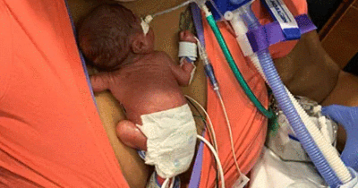Curtis Means è il neonato più prematuro di sempre: nato a 21 settimane. I medici: “Mai visto un bimbo così piccolo e forte”