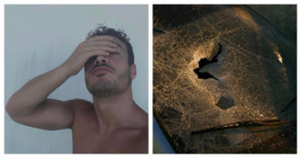 Copertina di Antonino Spinalbese in ospedale: il parabrezza frantumato e la flebo al braccio, cosa è successo al fidanzato di Belen Rodriguez