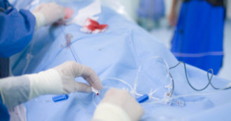 Copertina di Austria, chirurga amputa la gamba sbagliata a paziente 82enne: condannata a pagare 2700 euro di multa