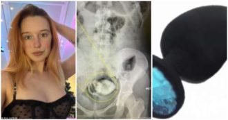 Copertina di Va in ospedale con un sex toys incastrato nell’intestino: “Stavo facendo una videochiamata con il mio fidanzato, poi ho sentito ‘pop’ e non c’era più”