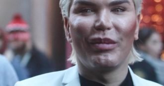 Non esistono trattamenti estetici senza cicatrici o con recuperi miracolosi. Basta fake news!