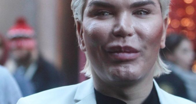 Non esistono trattamenti estetici senza cicatrici o con recuperi miracolosi. Basta fake news!