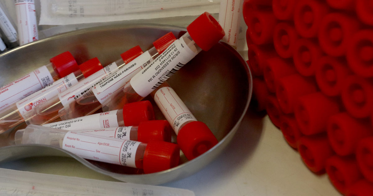 Omicron, Delta e ora spunta “Deltacron”. Ma in Italia la ricerca delle varianti è al minimo: nell’ultimo mese sequenziato solo lo 0,25% dei test