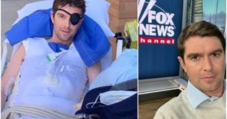Copertina di Benjamin Hall, il giornalista di Fox News ferito a Kiev: “Ho perso mezza gamba e un piede. Una mano mi è stata ricomposta, un occhio non funziona più”