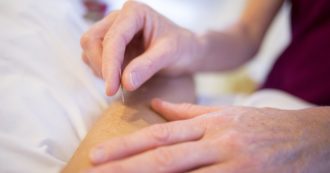 Agopuntura, medicina alternativa o integrativa? La parola all’esperto: “L’Oms la ritiene utile per 64 patologie. Ecco come”