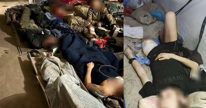 Guerra in Ucraina | A terra e senza farmaci: le foto dei feriti nell’ospedale in un rifugio di Azovstal diffuse dal comune di Mariupol