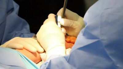 Copertina di Un neurochirurgo fa trapanare il cranio di un paziente alla figlia di 13 anni durante un’operazione: licenziato in tronco e la polizia indaga a tutto campo