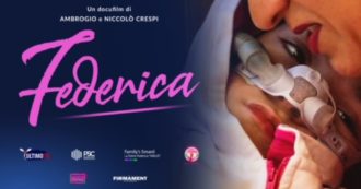 Copertina di ‘Federica’, il docufilm di Ambrogio Crespi sulla 14enne affetta da Smard1: “Per denunciare l’inerzia delle istituzioni” – GUARDA