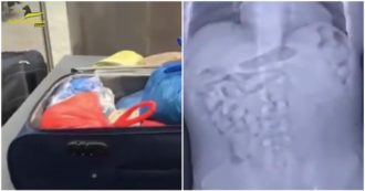Copertina di Ingerivano ovuli di cocaina per trasportarla in Italia: sgominato narcotraffico internazionale a Malpensa – Video