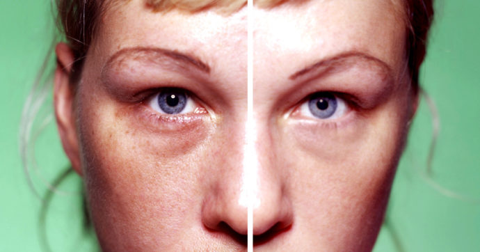 L’agenzia Ogilvy: “Non lavoreremo con influencer inglesi che ritoccano le foto”