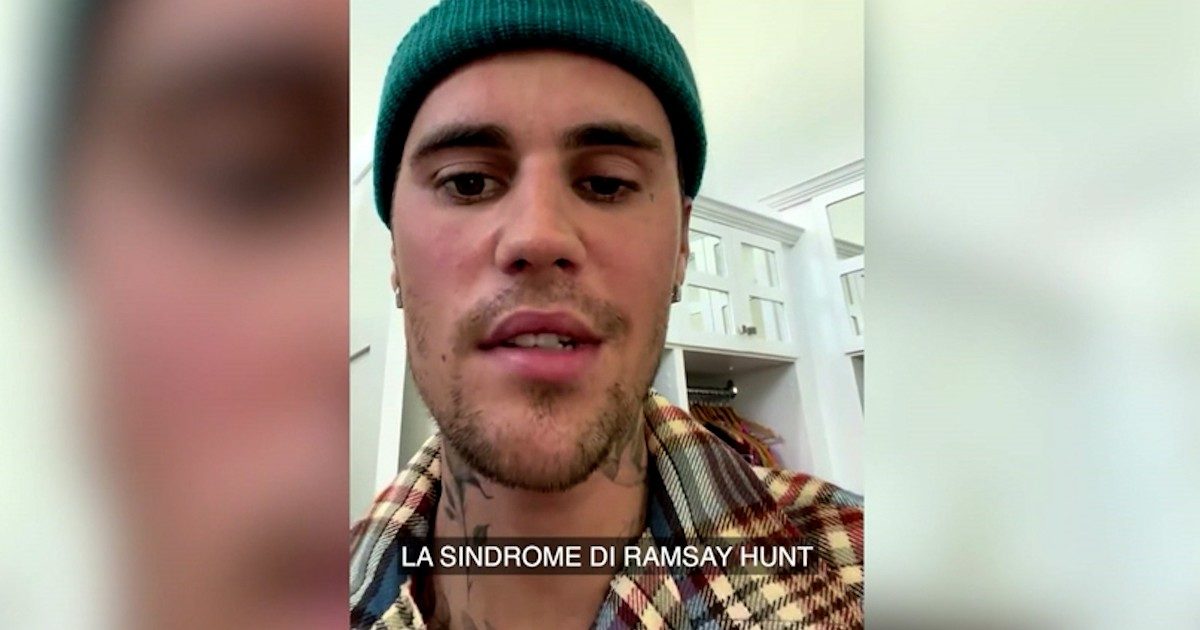 Sindrome Ramsay Hunt, cos’è la malattia che provoca una paralisi facciale a Justin Bieber: “Causata dalla riattivazione del virus Varicella-zoster”