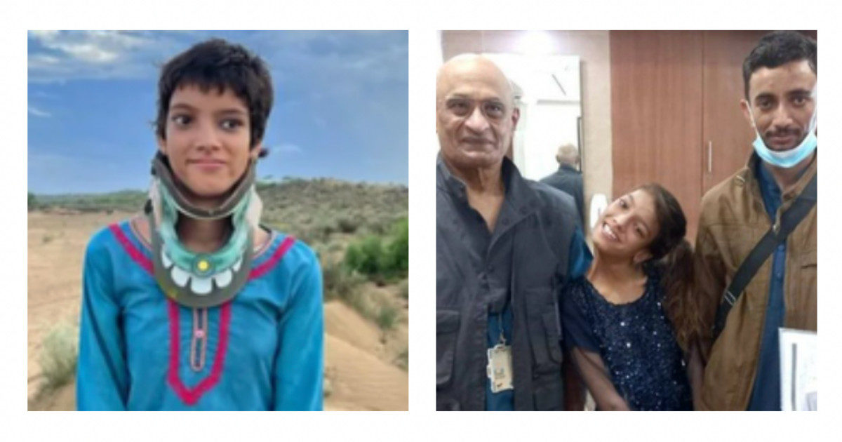 Dopo 13 anni con il collo piegato a causa di una caduta, trova un chirurgo che la opera pro bono: la storia di Afsheen Gul