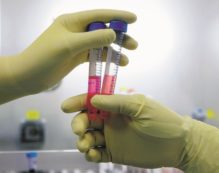 Copertina di Il magistrato lascia i  gemelli  del pertini a chi li ha partoriti