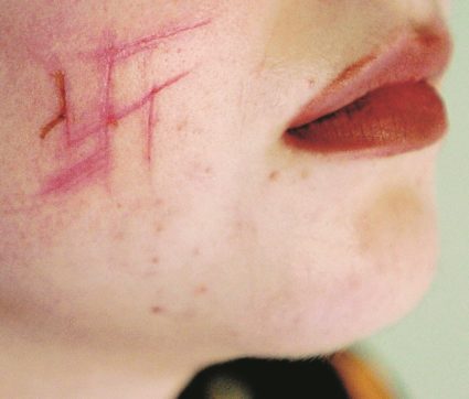 “Juden Raus!” : così l’Europa  (ri)scopre l’antisemitismo