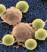 Copertina di L’Hiv per braccare le cellule tumorali