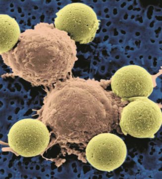 Copertina di L’Hiv per braccare le cellule tumorali