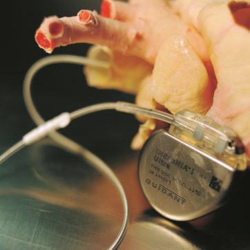 Copertina di Report colpisce al cuore nessuno controlla i pacemakers