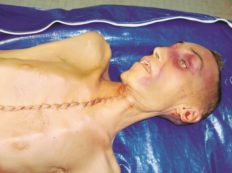 Copertina di Caso Cucchi: tutti assolti il solo colpevole è Stefano