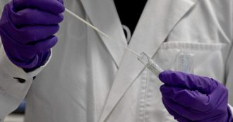 Copertina di Hiv, la nuova sofisticata tecnica messa a punto contro il virus per un possibile un vaccino