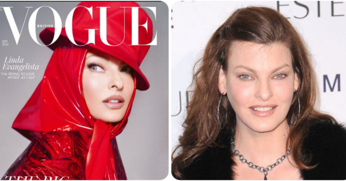 Linda Evangelista sulla copertina di Vogue dopo la criolipolisi che l’aveva sfigurata: “Sto cercando di amarmi per quella che sono”