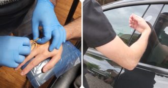 Copertina di Si fa impiantare nella mano la chiave per aprire la Tesla: VIDEO