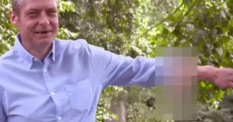 Copertina di L’uomo che ha vissuto 7 anni con un pene sul braccio: la storia arriva su Real Time