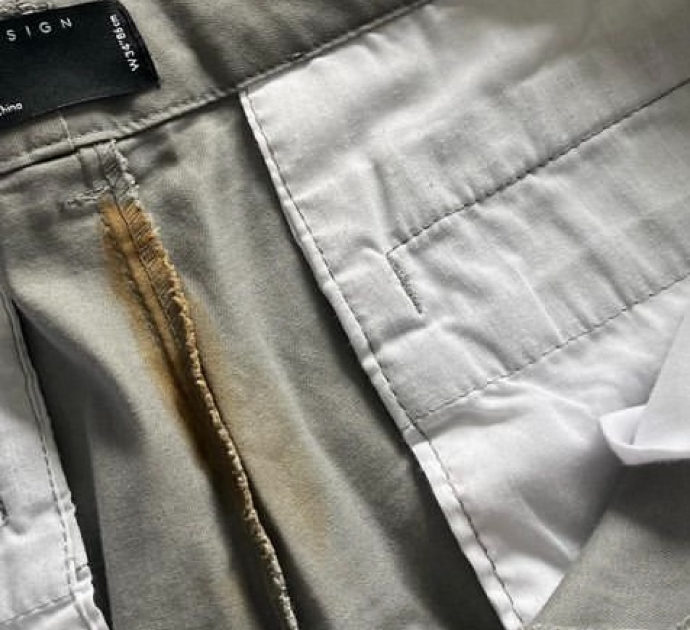 Compra dei pantaloncini online ma gli arrivano a casa macchiati e con un odore inconfondibile: la denuncia della giornalista contro Asos