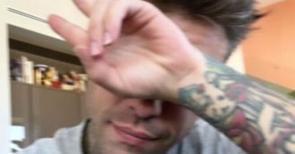 Copertina di Fedez, risonanza magnetica di controllo dopo il tumore al pancreas: “È andato tutto bene”