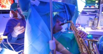 Copertina di Suona il sassofono mentre gli asportano un tumore al cervello: a Roma l’intervento chirurgico di ‘awake surgey’