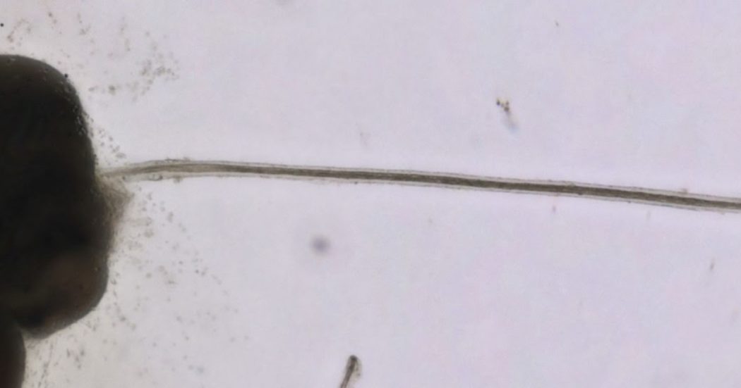 Realizzati e cresciuti in coltura follicoli piliferi completamente maturi. Lo studio su Science