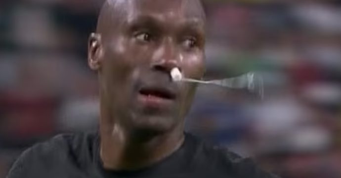 Domeniche Bestiali – Il capitano del Canada con un Tampax nel naso e il top player dello Zambia premiato con le uova