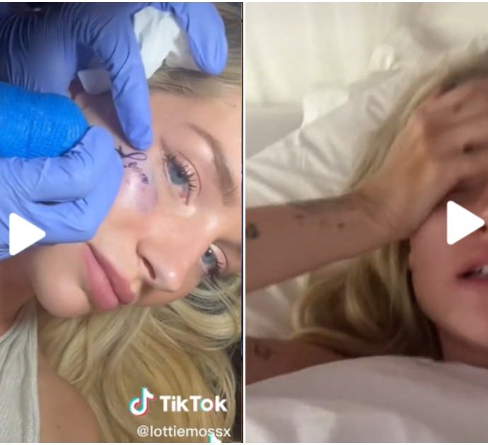 Lottie Moss si tatua la faccia durante una notte brava, il mattino dopo se ne pente: “Questo non sarebbe dovuto accadere”