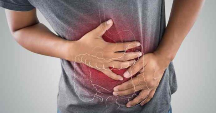 Sindrome dell’intestino irritabile, cos’è e come si combatte: “Colpisce prevalentemente donne tra i 20 e i 50 anni”. I consigli dell’esperto