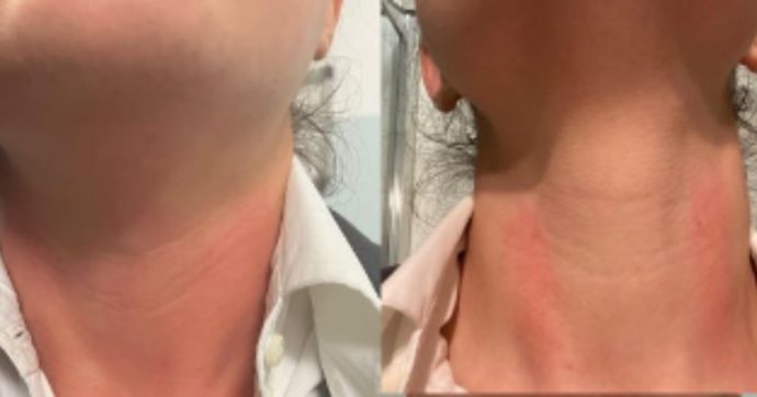 Udine, 28enne guardia medica aggredita durante il turno: l’accompagnatore di un paziente ha cercato di strangolarla
