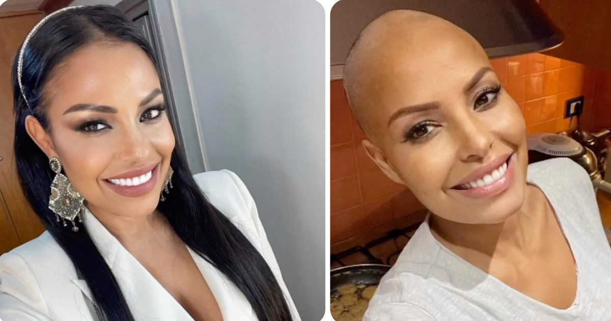 Carolina Marconi, foto con e senza parrucca nella giornata mondiale contro il cancro: “Non rimandate”