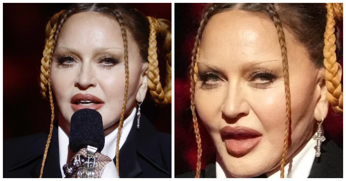Grammy Awards, la faccia di Madonna è irriconoscibile. I social si scatenano: “Sembra un vampiro che si nutre di bambini”