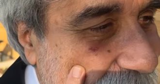 Copertina di Beppe Vessicchio non vede la vetrata della villa di Fedez e ci sbatte contro: il livido all’occhio è subito virale