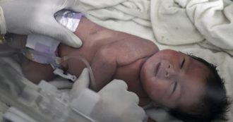 Copertina di Terremoto, “tentativo di rapimento” per la neonata salvata dalle macerie in Siria. La piccola Aya trasferita in un luogo sicuro