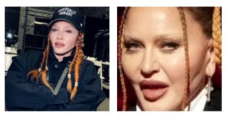 Copertina di Madonna prende in giro chi la criticava per il ricorso (“eccessivo”) alla chirurgia: “Guarda come sono carina ora che mi sono sgonfiata”