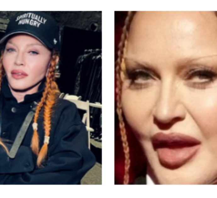 Madonna prende in giro chi la criticava per il ricorso (“eccessivo”) alla chirurgia: “Guarda come sono carina ora che mi sono sgonfiata”